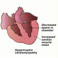 Abnormal breathing - definition of Abnormal breathing by