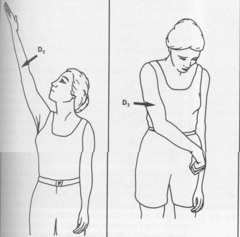 Is Too Much Stretching Bad For You? YTU Takes You From