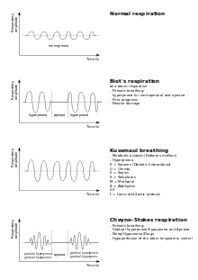 Control of Breathing and Abnormal Breathing Patterns